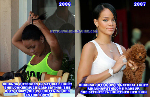 Rihanna Skin Bleaching Before and After