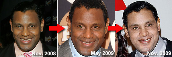 Sammy Sosa Bleached Skin