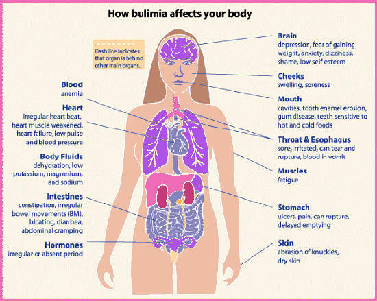 Name:  bulimia.jpg
Views: 121
Size:  55.5 KB