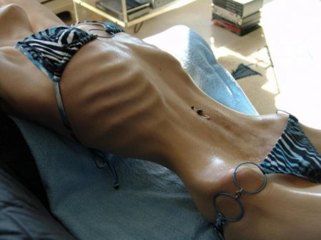 Name:  anorexic.jpg
Views: 116
Size:  24.8 KB