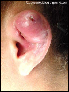 Name:  infection.jpg
Views: 80
Size:  15.0 KB