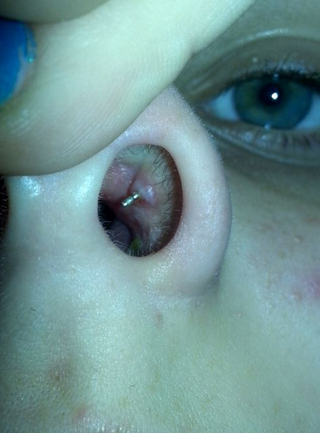 Name:  swelling.png
Views: 103964
Size:  333.3 KB