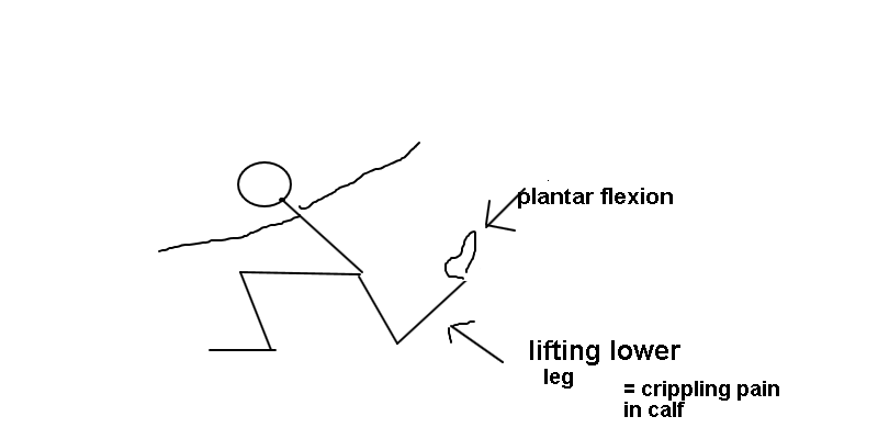 Name:  plantar.png
Views: 1751
Size:  52.0 KB