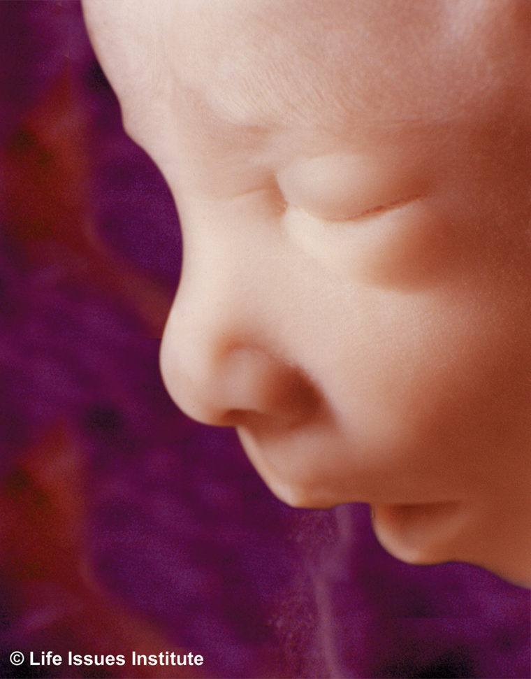 Name:  16-week-fetus-760x971.jpg
Views: 22
Size:  109.5 KB
