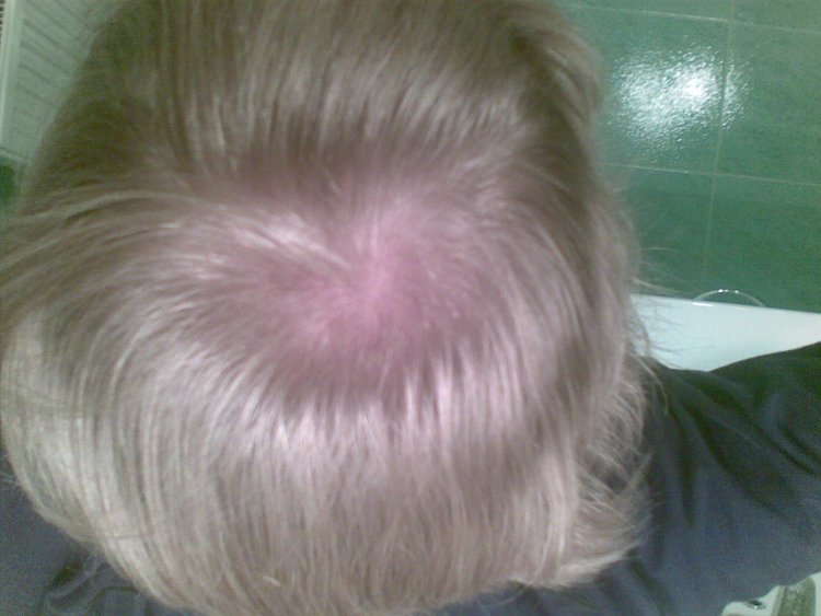Hair crown